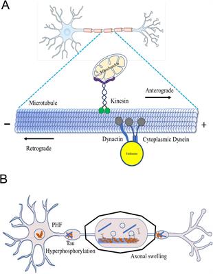 Unraveling the interplay of kinesin-1, tau, and microtubules in neurodegeneration associated with Alzheimer’s disease